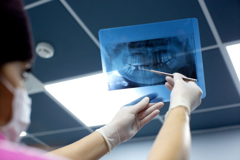 tecnico rayos dental